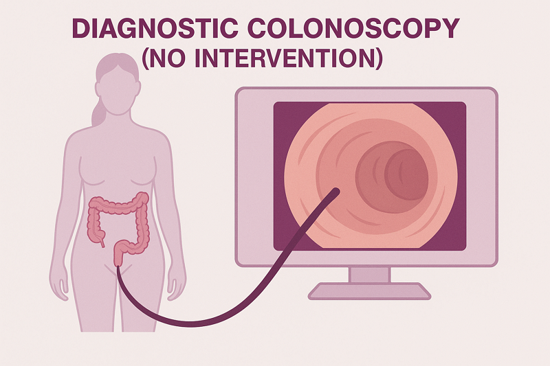 Diagnostic Colonoscopy Graphic