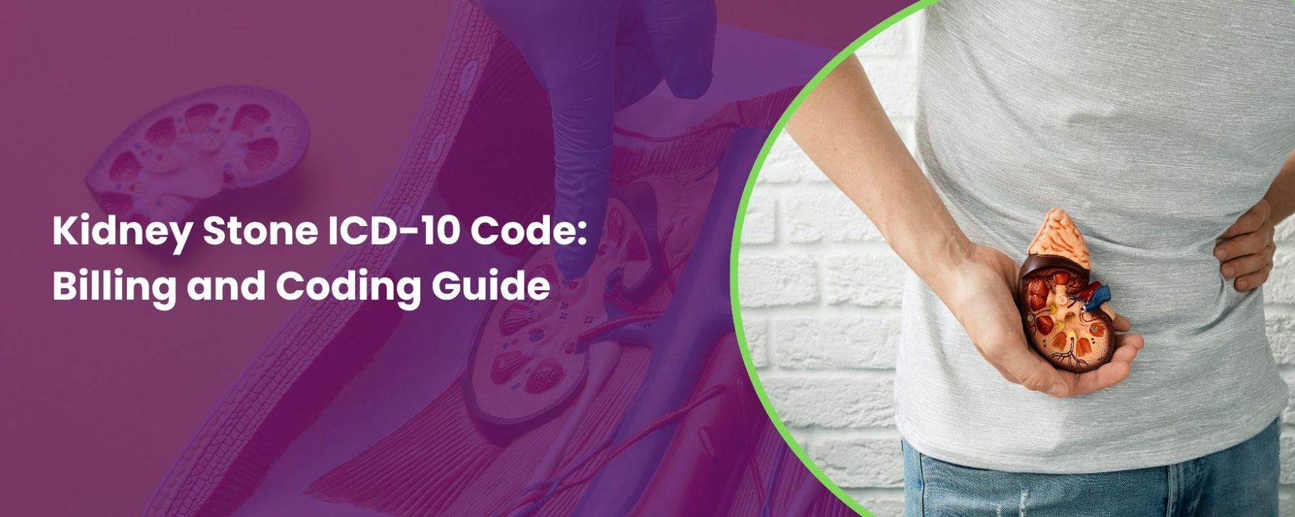 Kidney Stone ICD-10 Code: Billing and Coding Guide